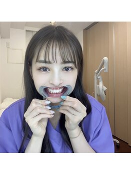 ライトビューティー 銀座店(LightBeauty)/かんたんホワイトニングの手順３