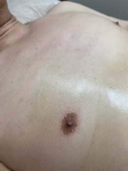 サロンアンドスクール ローズマリー (Salon&School Rosemary)/男性ブラジリアンワックス