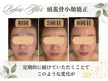 グレースフィオーレ 高槻店(gracefiore)/お客様のビフォーアフター