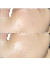 ちらちゅら/イラストリアス