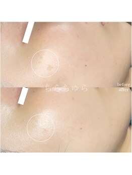 ちらちゅら/イラストリアス