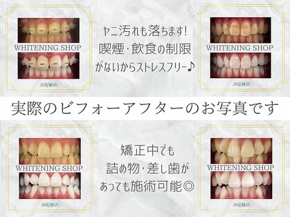 ホワイトニングショップ 尼崎店の写真
