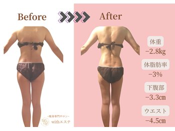 ウィズエステ(withエステ)/