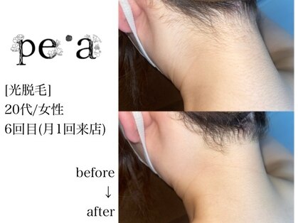 ペア(pe'a)の写真