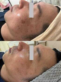 イーサロン(eii salon)/40代男性