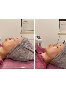 お肌をきれいにしたい