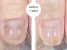 深爪噛み爪でお悩みだったお客様
