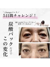 ララスマイル 鶴崎森町店/お肌改善プログラム(たるみケア)