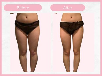 アールエイチビー 藤沢店(RHB)/