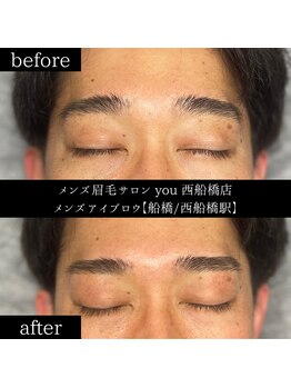 ユー 西船橋店(you)/ビフォーアフター写真