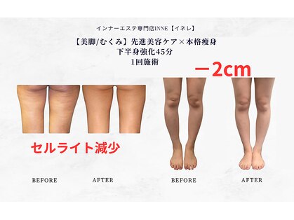 イネレ(INNE)の写真