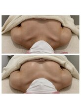 サロンドコーデ(salon de co-de)/本気でバストを変える育乳専門店