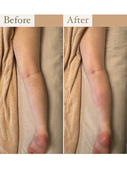 シズク(sizucu)/冷え浮腫み改善☆