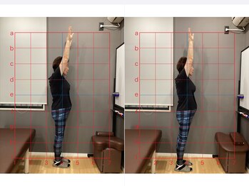 摂津本山駅前鍼灸整骨院/ビフォーアフターになります！