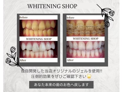 ホワイトニングショップ 四条店の写真