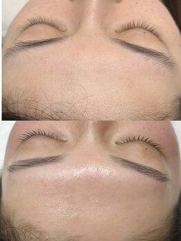 アイコトバ バイ ジュモク(アイコトバ by Jumoku)/フェイスワックスおでこ+眉毛