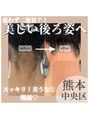 アート 熊本並木坂店(ART) うなじ 脱毛