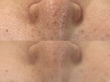 ヴェルシック(Belchic)の雰囲気（【毛穴特化の復元フェイシャル】お顔の毛穴全てをキレイにできる）