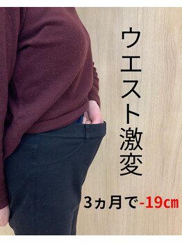 すなお 二日市整骨院/ペタンコお腹