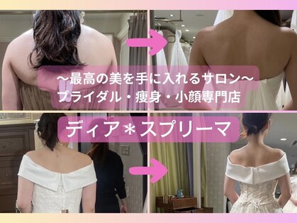 ディア スプリーマの写真