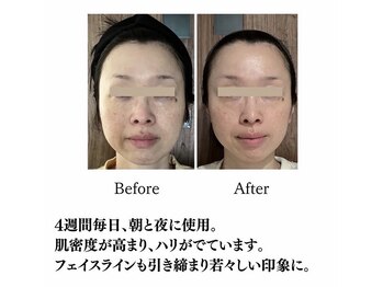 ララスマイル 鶴崎森町店/お肌改善プログラム(たるみケア)