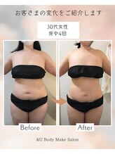 アンドユー(&U)/