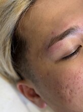 イスリーツー(ithree.2)/パラレルブロウリフト