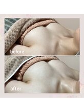 セレーネ(Selene)/お客様before.after