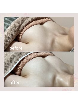 セレーネ(Selene)/お客様before.after