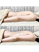 エン ボディアンドフェイシャル(En)/ハイパーナイフ・二の腕引き締め