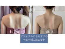 シンシア(sincere)/コルギの効果は顔だけじゃない