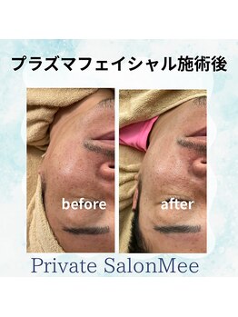 ミー(Mee)/女性にも☆男性にもおすすめ