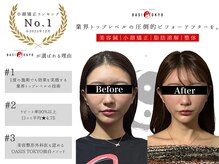ネオオアシストウキョウ(ネオ OASIS TOKYO)