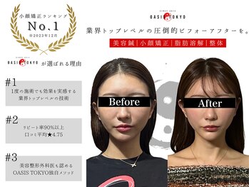 ネオオアシストウキョウ(ネオ OASIS TOKYO)