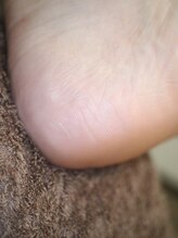 ピサラ(PISAR)/フットケア施術後