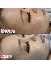 グリッター(GLITTER)/色ムラ改善