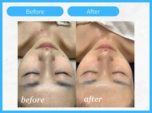 トウメイコガオ 横浜店/トウメイコガオでハーブ