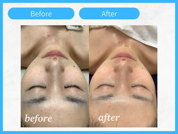 トウメイコガオ 横浜店/トウメイコガオでハーブ