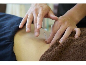 ハレユイ鍼灸整骨院の写真/【自律神経や不眠のお悩みに】鍼灸で体の内側から整え、40代・50代女性のゆらぐ不調を優しくケア！