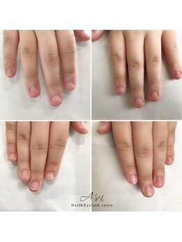 ネイルアンドアイラッシュ アヴィ(Nail and Eyelash A'vi)/自爪育成３回コース