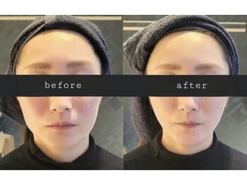 ナム 上野店(Namu)/お悩みを一緒に解決♪