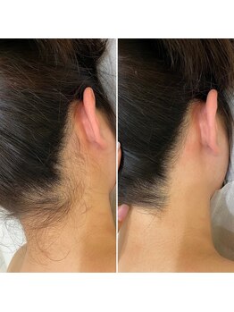 インベスト(INVEST)/Befor After