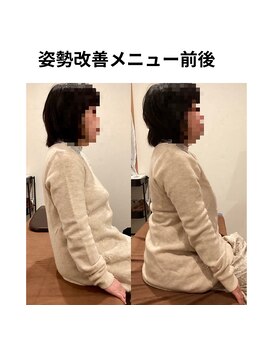 ひろ整骨院/姿勢改善コース　施術前後