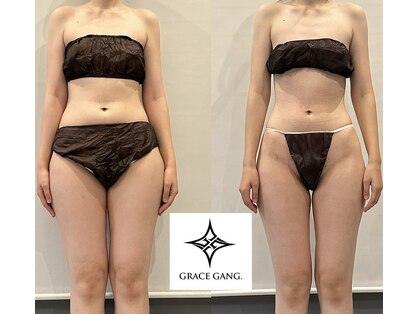 グレースギャング(GRACE GANG.)の写真