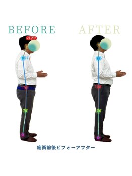 アティチュード 高崎(ATTITUDE)/デスクワークによる首コリ