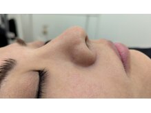 ブリーゼ湘南/小鼻の毛穴洗浄ｙってます！