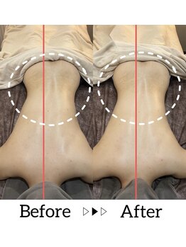 リラ 郡山店(Lilas)/お身体歪んでませんか？