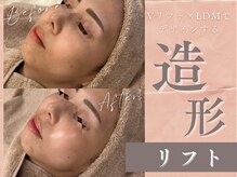 アマテラススキンラウンジ(Amatelas SKIN LOUNGE)