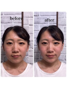 シャルム(CHARMEB)/眼精疲労スッキリ