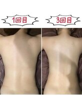 フローボディ 新山口店(flow BODY)/山口のエステはflow BODY